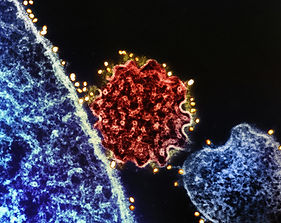 Colorized transmission electron micrograph of a single Nipah virus particle (center, colorized red) that has budded from the surface of an infected cell (blue). Credit: NIAD